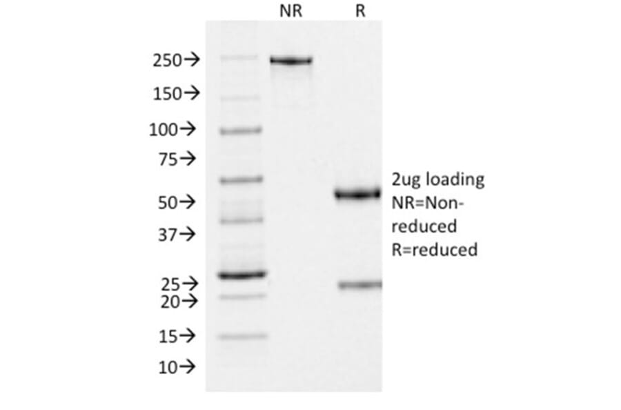 SDS-PAGE - Anti-Melanoma gp100 Antibody [PMEL/2037] - BSA and Azide free (A253153) - Antibodies.com