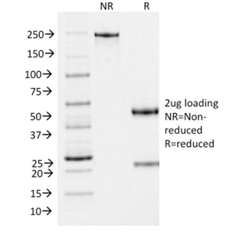 SDS-PAGE - Anti-Melanoma gp100 Antibody [PMEL/2037] - BSA and Azide free (A253153) - Antibodies.com