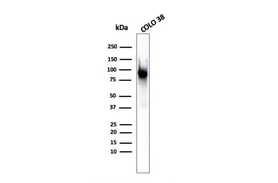Western Blot - Anti-Melanoma gp100 Antibody [PMEL/2037] - BSA and Azide free (A253153) - Antibodies.com