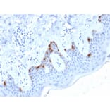 Immunohistochemistry - Anti-Melanoma gp100 Antibody [PMEL/2038] - BSA and Azide free (A253154) - Antibodies.com