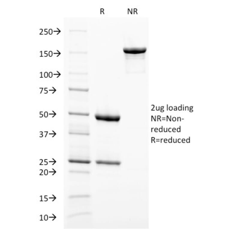 SDS-PAGE - Anti-Melanoma gp100 Antibody [PMEL/2038] - BSA and Azide free (A253154) - Antibodies.com