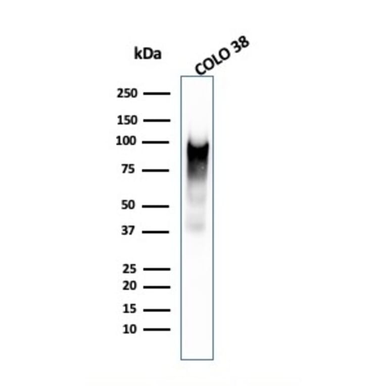Western Blot - Anti-Melanoma gp100 Antibody [PMEL/2038] - BSA and Azide free (A253154) - Antibodies.com