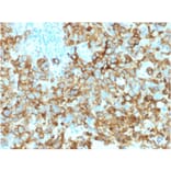 Immunohistochemistry - Anti-Melanoma gp100 Antibody [PMEL/2039] - BSA and Azide free (A253155) - Antibodies.com