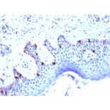 Immunohistochemistry - Anti-Melanoma gp100 Antibody [PMEL/2039] - BSA and Azide free (A253155) - Antibodies.com