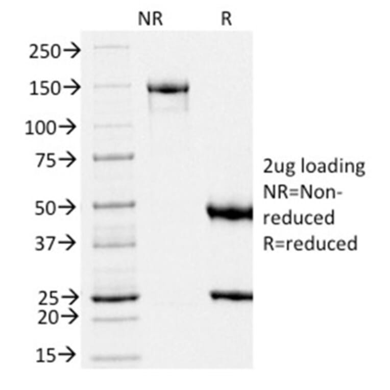 SDS-PAGE - Anti-Melanoma gp100 Antibody [PMEL/2039] - BSA and Azide free (A253155) - Antibodies.com