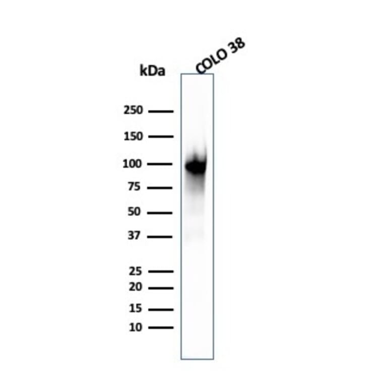 Western Blot - Anti-Melanoma gp100 Antibody [PMEL/2039] - BSA and Azide free (A253155) - Antibodies.com