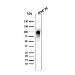 Western Blot - Anti-Melanoma gp100 Antibody [PMEL/2039] - BSA and Azide free (A253155) - Antibodies.com
