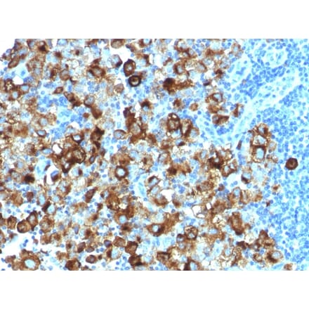 Immunohistochemistry - Anti-Melanoma gp100 Antibody [PMEL/1825R] - BSA and Azide free (A253155) - Antibodies.com