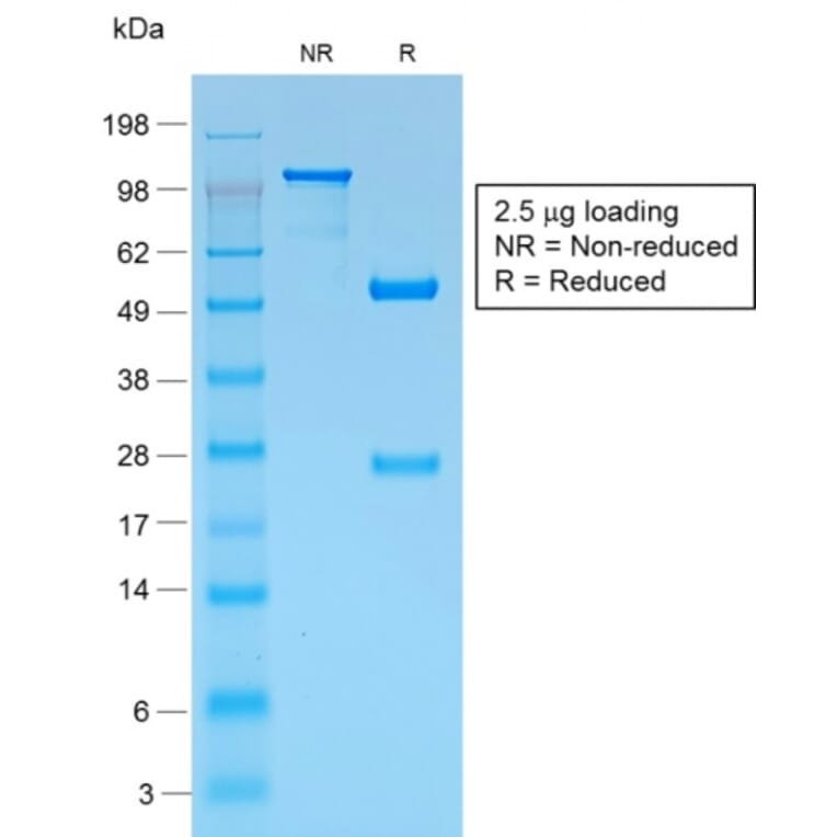 SDS-PAGE - Anti-Melanoma gp100 Antibody [PMEL/1825R] - BSA and Azide free (A253156) - Antibodies.com