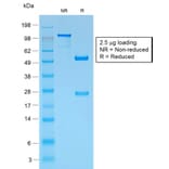 SDS-PAGE - Anti-Melanoma gp100 Antibody [PMEL/1825R] - BSA and Azide free (A253156) - Antibodies.com