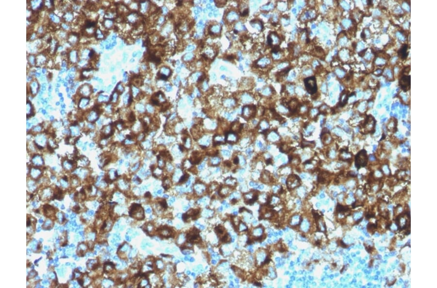 Immunohistochemistry - Anti-Melanoma gp100 Antibody - BSA and Azide free (A253156) - Antibodies.com