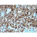 Immunohistochemistry - Anti-Melanoma gp100 Antibody - BSA and Azide free (A253156) - Antibodies.com