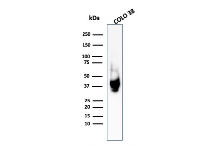 Western Blot - Anti-Melanoma gp100 Antibody - BSA and Azide free (A253157) - Antibodies.com