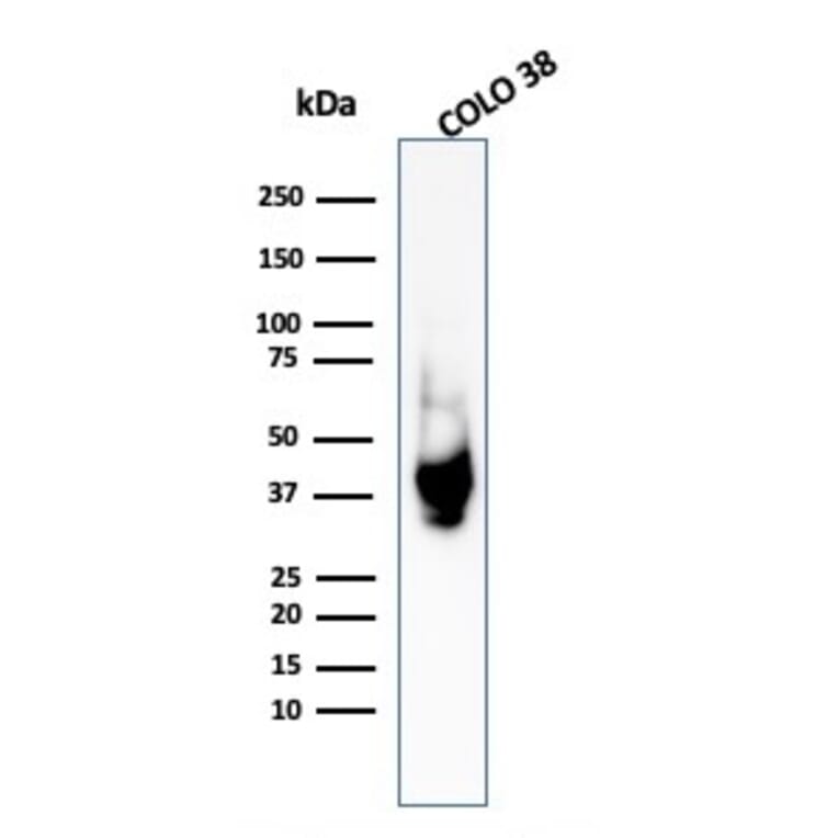 Western Blot - Anti-Melanoma gp100 Antibody - BSA and Azide free (A253157) - Antibodies.com