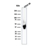 Western Blot - Anti-Melanoma gp100 Antibody - BSA and Azide free (A253157) - Antibodies.com