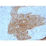 Immunohistochemistry - Anti-GLUT1 Antibody [GLUT1/2475] - BSA and Azide free (A253158) - Antibodies.com