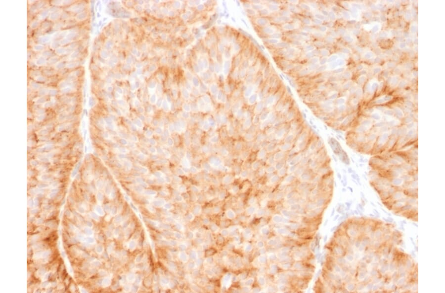 Immunohistochemistry - Anti-GLUT1 Antibody [GLUT1/2475] - BSA and Azide free (A253158) - Antibodies.com