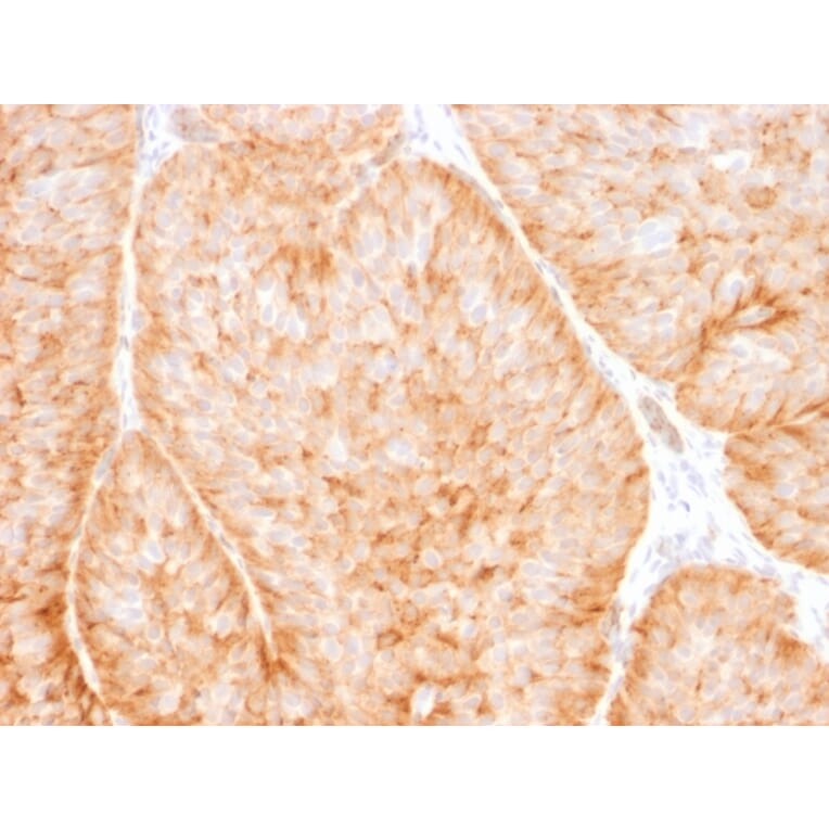 Immunohistochemistry - Anti-GLUT1 Antibody [GLUT1/2475] - BSA and Azide free (A253158) - Antibodies.com