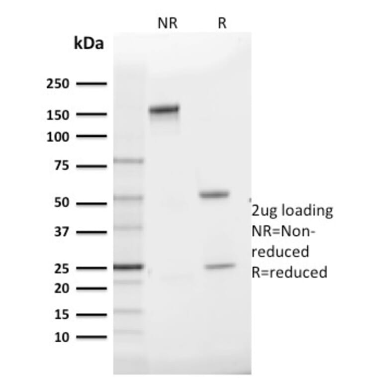 SDS-PAGE - Anti-GLUT1 Antibody [GLUT1/2475] - BSA and Azide free (A253158) - Antibodies.com