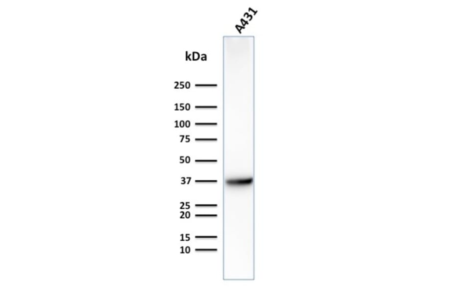 Western Blot - Anti-GLUT1 Antibody [GLUT1/2475] - BSA and Azide free (A253158) - Antibodies.com