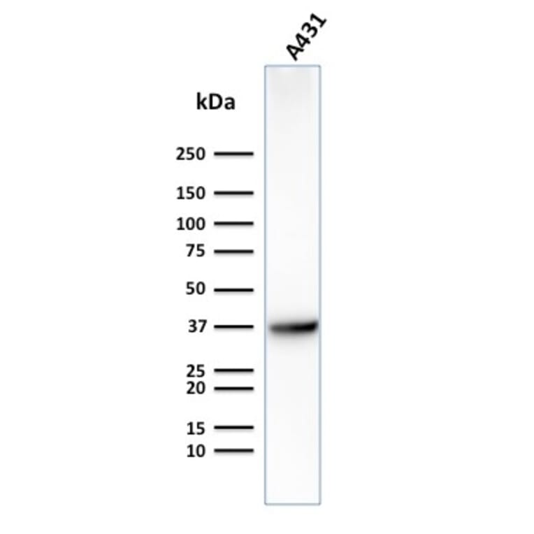 Western Blot - Anti-GLUT1 Antibody [GLUT1/2475] - BSA and Azide free (A253158) - Antibodies.com