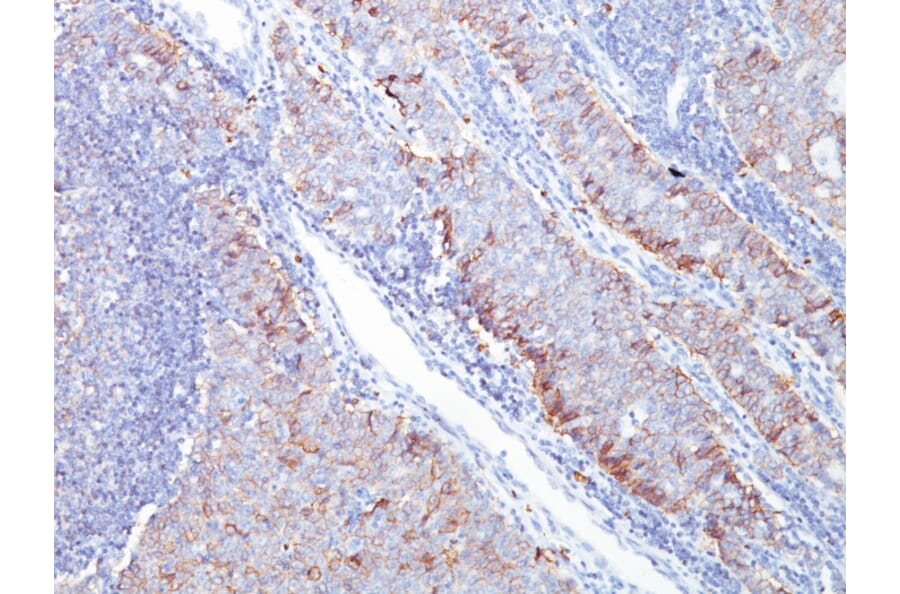 Immunohistochemistry - Anti-GLUT1 Antibody [GLUT1/2476] - BSA and Azide free (A253159) - Antibodies.com