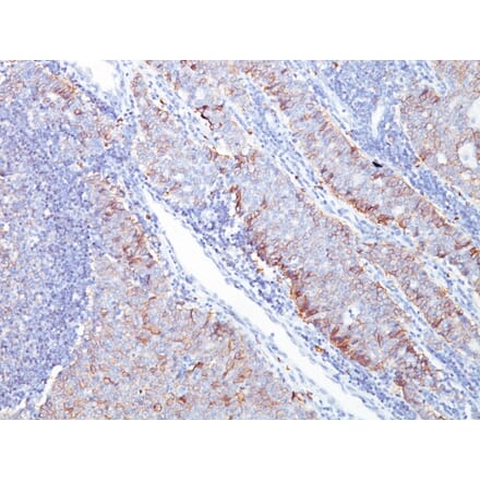 Immunohistochemistry - Anti-GLUT1 Antibody [GLUT1/2476] - BSA and Azide free (A253159) - Antibodies.com