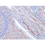 Immunohistochemistry - Anti-GLUT1 Antibody [GLUT1/2476] - BSA and Azide free (A253159) - Antibodies.com