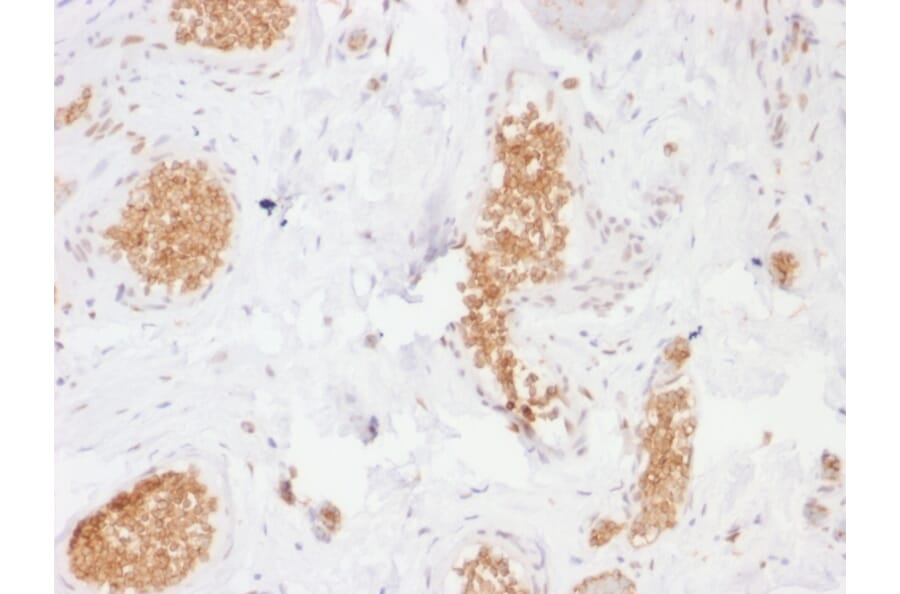 Immunohistochemistry - Anti-GLUT1 Antibody [GLUT1/2476] - BSA and Azide free (A253159) - Antibodies.com