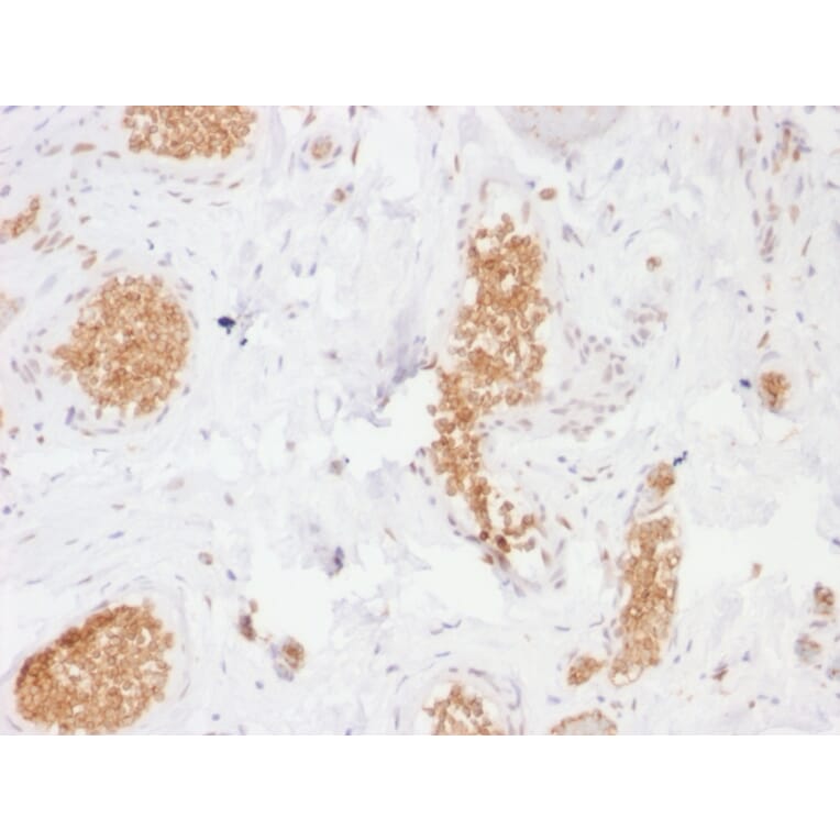 Immunohistochemistry - Anti-GLUT1 Antibody [GLUT1/2476] - BSA and Azide free (A253159) - Antibodies.com