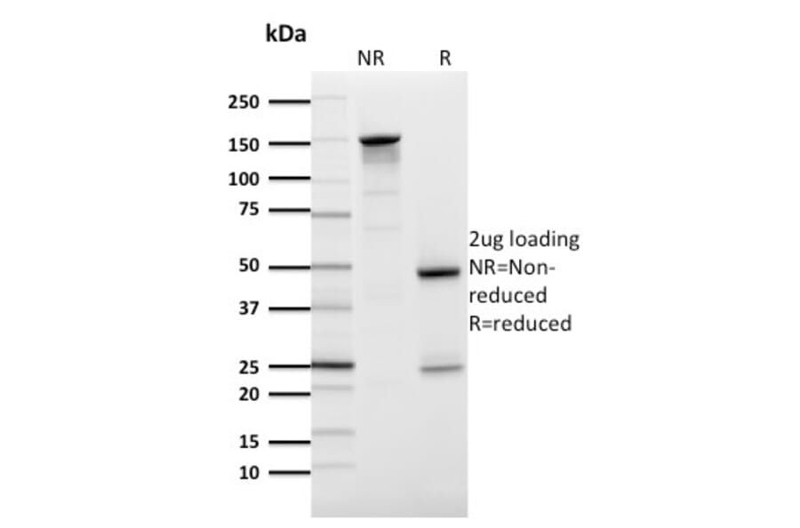 SDS-PAGE - Anti-GLUT1 Antibody [GLUT1/2476] - BSA and Azide free (A253159) - Antibodies.com