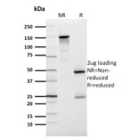 SDS-PAGE - Anti-GLUT1 Antibody [GLUT1/2476] - BSA and Azide free (A253159) - Antibodies.com