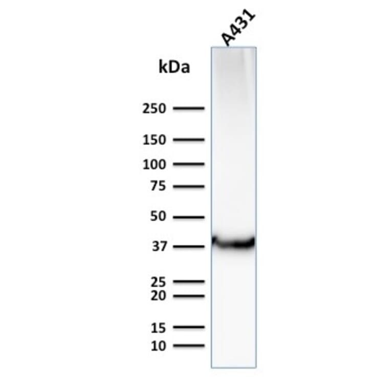 Western Blot - Anti-GLUT1 Antibody [GLUT1/2476] - BSA and Azide free (A253159) - Antibodies.com