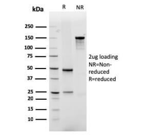 SDS-PAGE - Anti-GLUT1 Antibody [rGLUT1/2476] - BSA and Azide free (A253160) - Antibodies.com