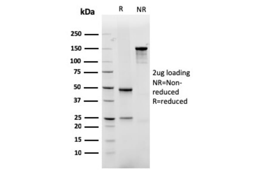 SDS-PAGE - Anti-GLUT1 Antibody [rGLUT1/2476] - BSA and Azide free (A253160) - Antibodies.com