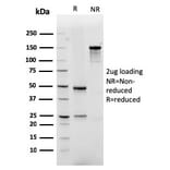 SDS-PAGE - Anti-GLUT1 Antibody [rGLUT1/2476] - BSA and Azide free (A253160) - Antibodies.com