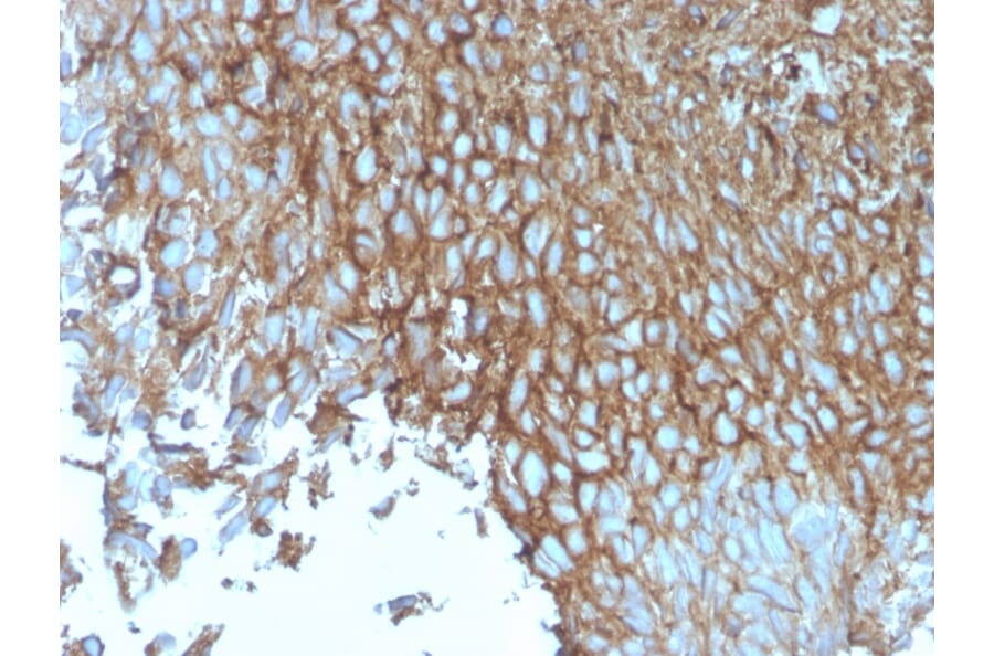 Immunohistochemistry - Anti-GLUT1 Antibody [rGLUT1/2476] - BSA and Azide free (A253159) - Antibodies.com