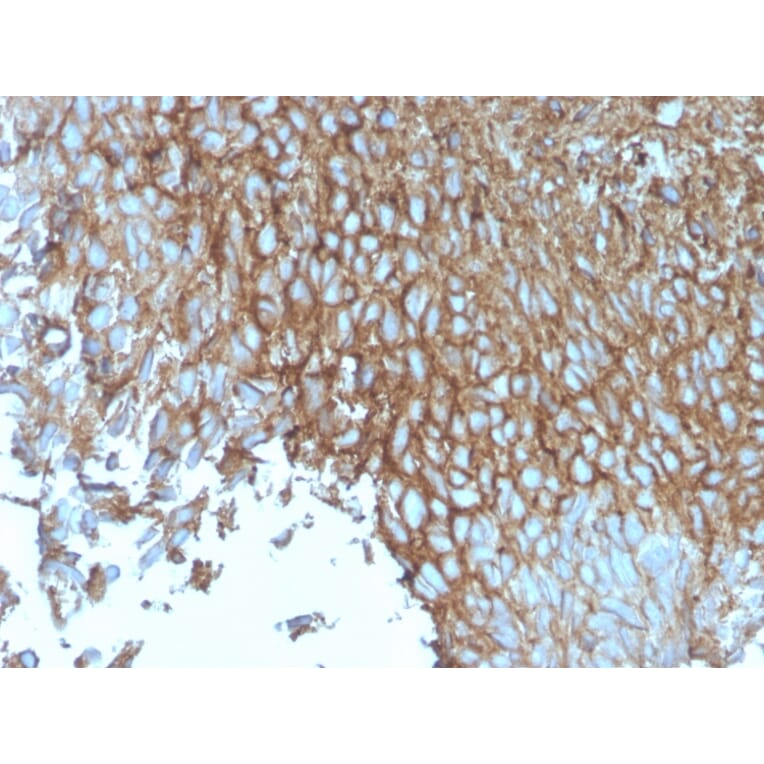 Immunohistochemistry - Anti-GLUT1 Antibody [rGLUT1/2476] - BSA and Azide free (A253159) - Antibodies.com