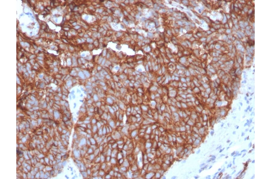 Immunohistochemistry - Anti-GLUT1 Antibody [GLUT1/3132R] - BSA and Azide free (A253161) - Antibodies.com
