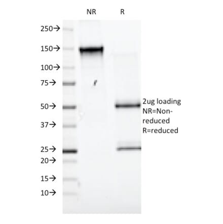 SDS-PAGE - Anti-CD98 Antibody [UM7F8] - BSA and Azide free (A253161) - Antibodies.com