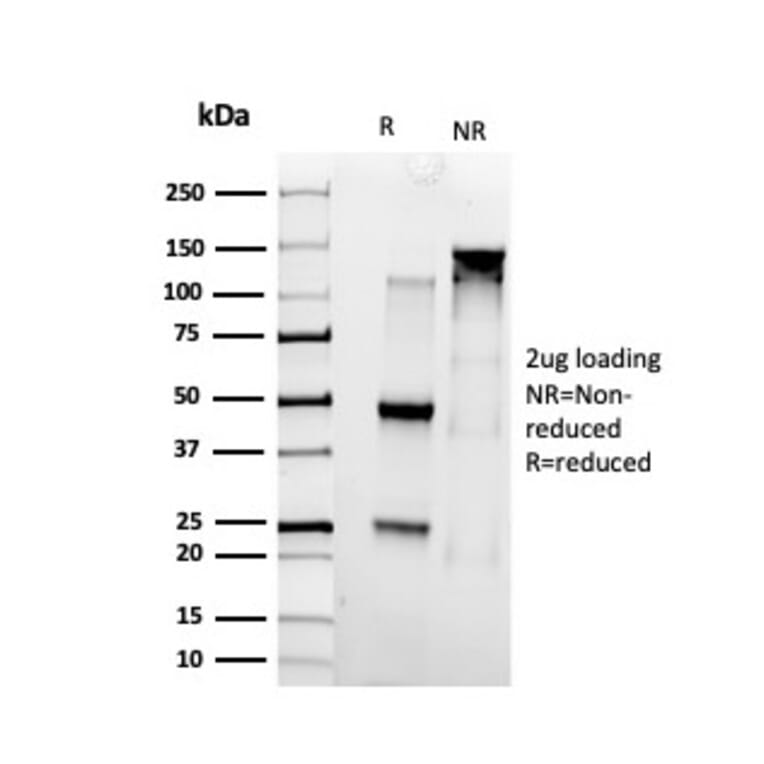 SDS-PAGE - Anti-SMARCC1 Antibody [PCRP-SMARCC1-1F1] - BSA and Azide free (A253164) - Antibodies.com