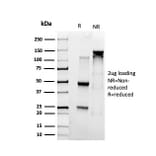 SDS-PAGE - Anti-SMARCC1 Antibody [PCRP-SMARCC1-1F1] - BSA and Azide free (A253164) - Antibodies.com