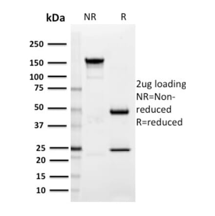 SDS-PAGE - Anti-SIGLEC1 Antibody [HSn 7D2] - BSA and Azide free (A253168) - Antibodies.com