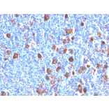 Immunohistochemistry - Anti-Fascin Antibody [FSCN1/416] - BSA and Azide free (A253170) - Antibodies.com