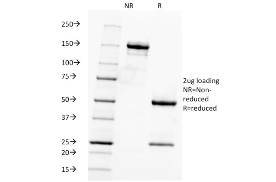 SDS-PAGE - Anti-Fascin Antibody [FSCN1/416] - BSA and Azide free (A253170) - Antibodies.com