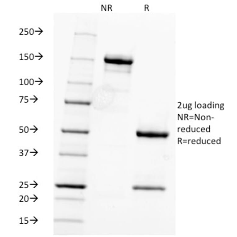 SDS-PAGE - Anti-Fascin Antibody [FSCN1/416] - BSA and Azide free (A253170) - Antibodies.com