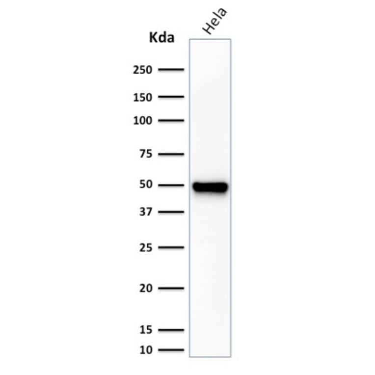 Western Blot - Anti-Fascin Antibody [FSCN1/416] - BSA and Azide free (A253170) - Antibodies.com