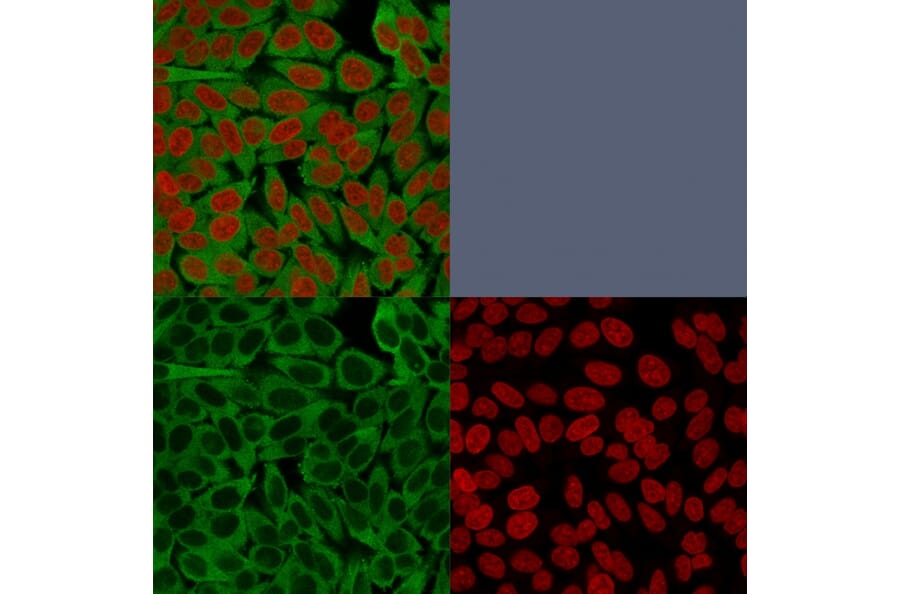 Immunofluorescence - Anti-Fascin Antibody [FSCN1/416] - BSA and Azide free (A253170) - Antibodies.com