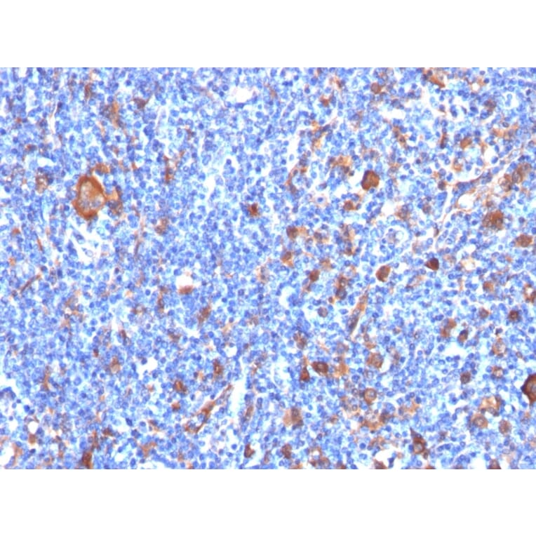 Immunohistochemistry - Anti-Fascin Antibody [FSCN1/417] - BSA and Azide free (A253171) - Antibodies.com