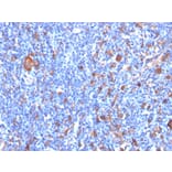 Immunohistochemistry - Anti-Fascin Antibody [FSCN1/417] - BSA and Azide free (A253171) - Antibodies.com